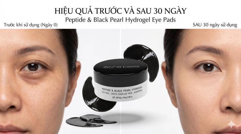 /san-pham/mat-na-mat-etre-belle-peptide-ngoc-trai-den-chong-lao-hoa-giam-bong-mat-quang-tham.html