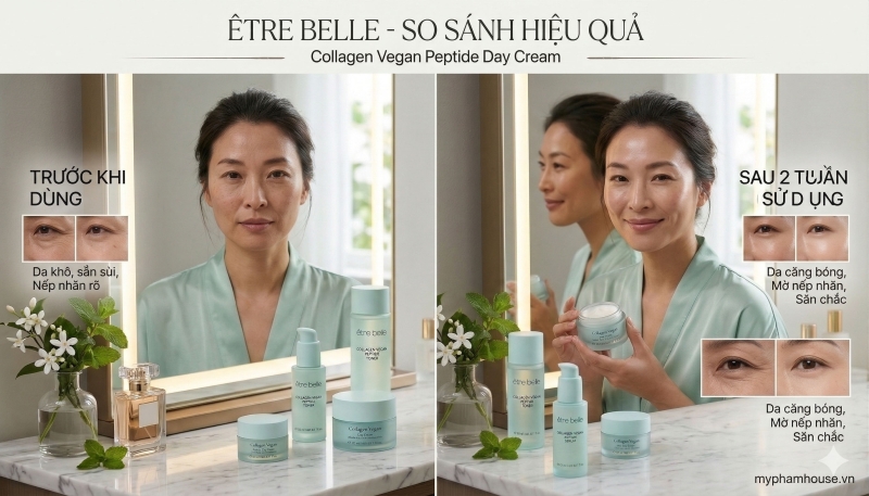 /san-pham/etre-belle-collagen-vegan-peptide-day-cream-cap-am-sau-nang-co-san-chac-da-tuc-thi.html