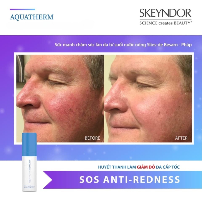 Skeyndor Aquatherm sos anti redness