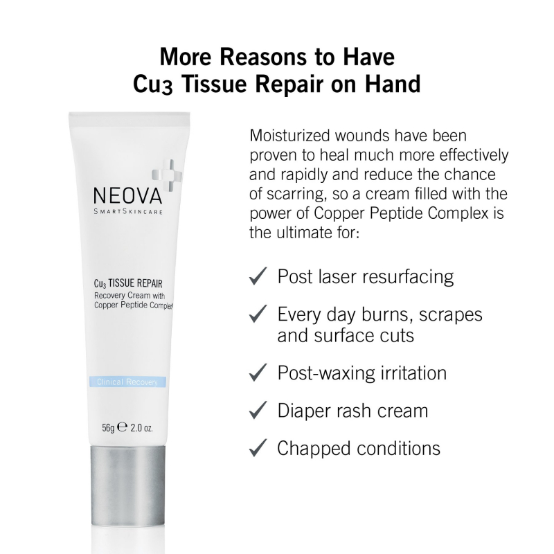 Kem siêu phục hồi da sau tổn thương Neova Cu3 Tissue Repair