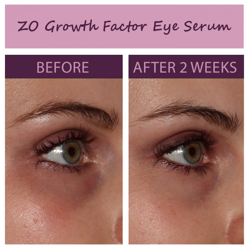Zo Skin Health Growth Factor Serum – Tinh chất trẻ hóa và xóa nếp nhăn sâu da vùng mắt